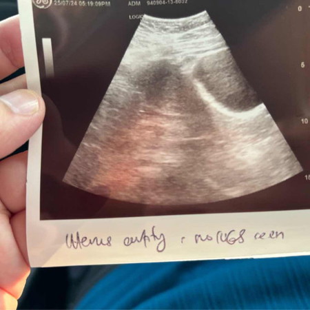 6 weeks scan