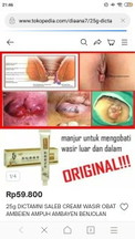 Bunda2 ada yg tau gak obat ambeyen yg bagus untuk bumil yg rekomen ambeyen kluar tp GK sakit bun