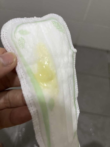 Keputihan semasa pregnant 9months. Normal ke?