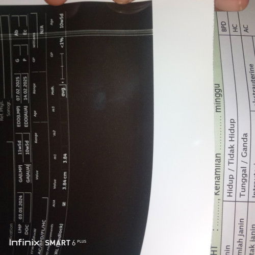 HASIL USG TAK SEPERTI PUNYA YANG LAIN