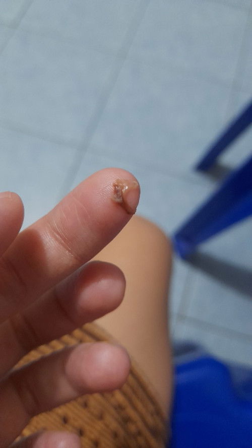 Mengandung 10 minngu 2 hari