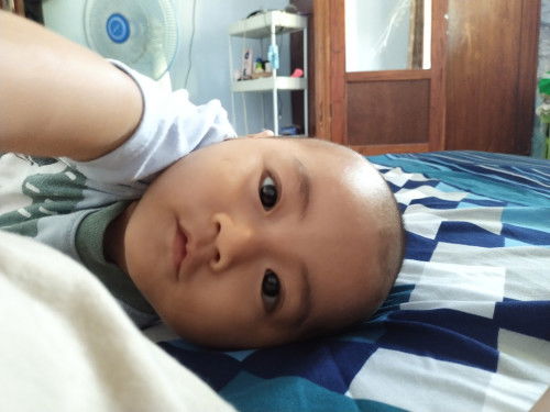 Lazy eyes atau bykan