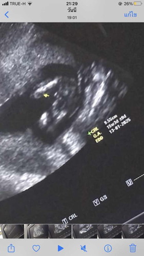 แบบนี้ชายหรือหญิงคะ