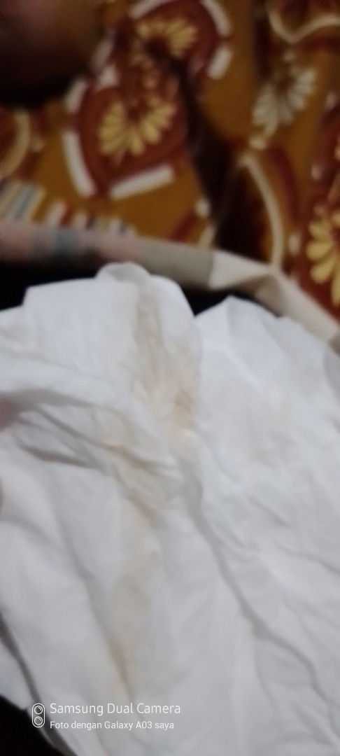 Kecoklatan usia kehamilan 38week