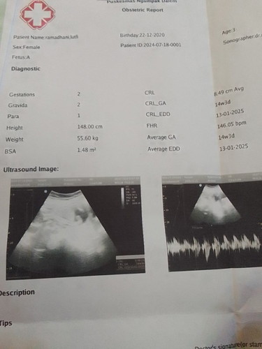Bun maaf mau tanya itu hasil usg dari puskesmas. Kira" uk janin sama usia nya sesuai gk ya??