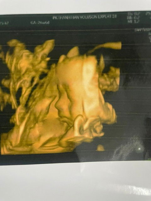 Bầu 24tuần 6 ngày