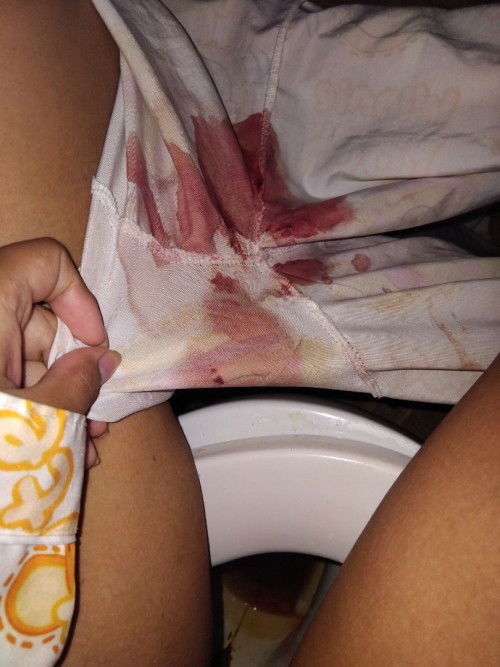 มีใครเป็นบ้างไหมคะ