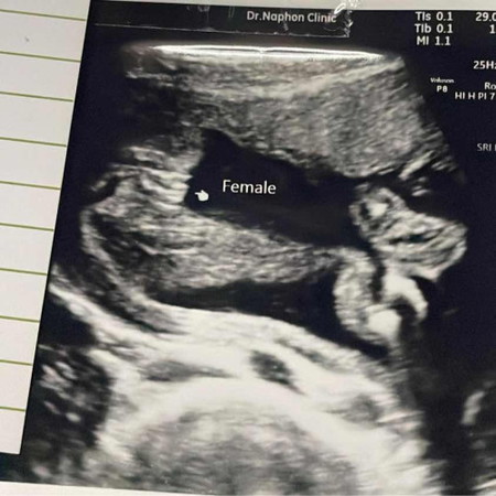 เพศหญิงหรือชายคะ