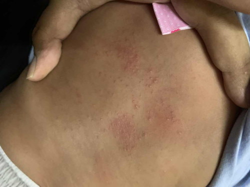 RUAM BADAN BELAKANG