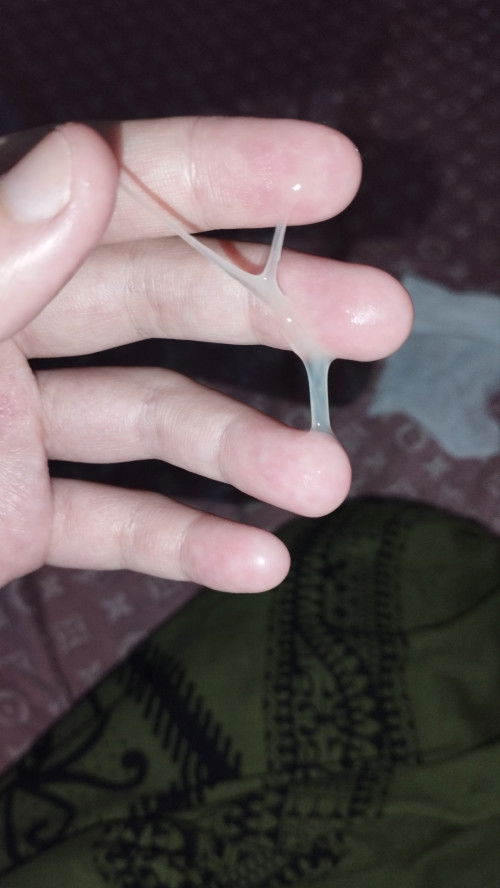 hamil anak pertama 34w