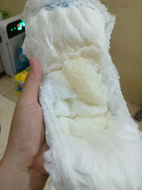 Pipis bayi sedikit kuning