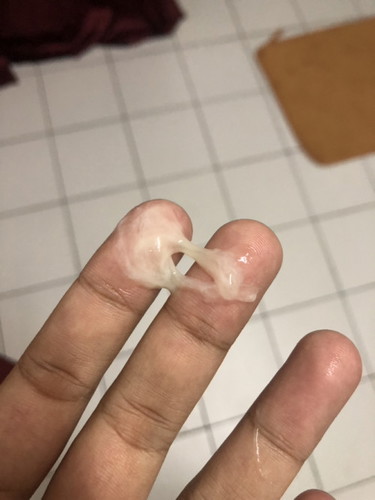 mucus plug