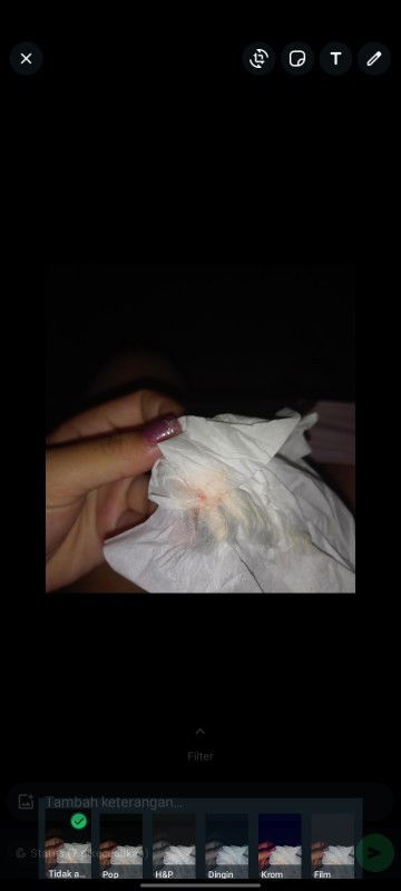 Usia kehamilan 9 bulan hpl 14 agustus keluar lendir gini tanda apa bun