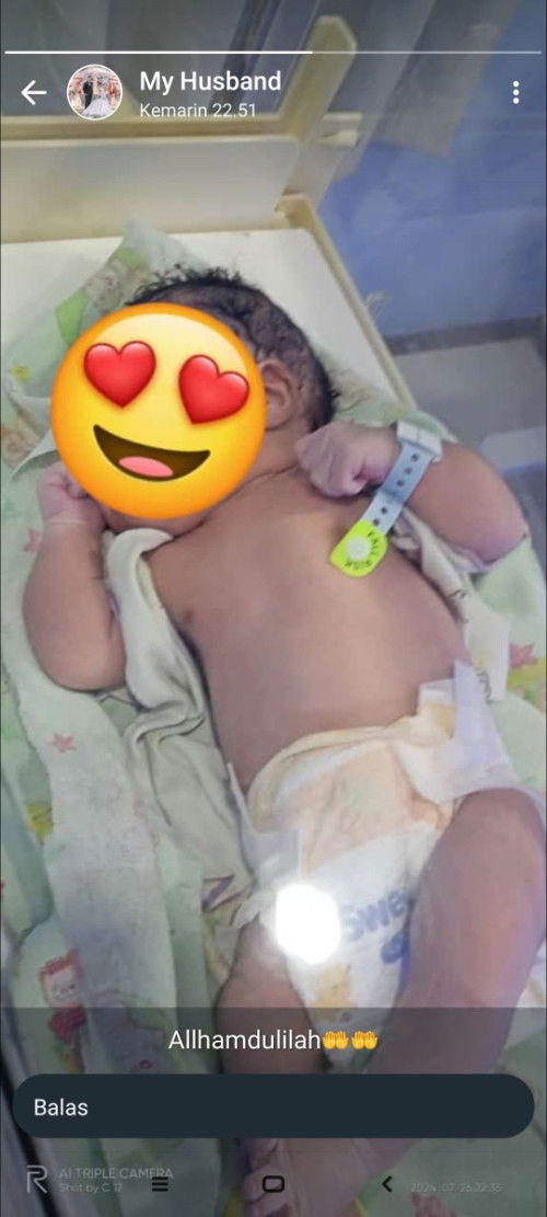 Hpl 31 juli sudah lahir 26 juli 2024