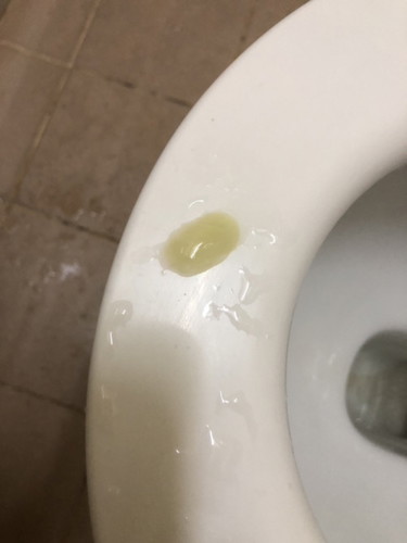 mucus plug