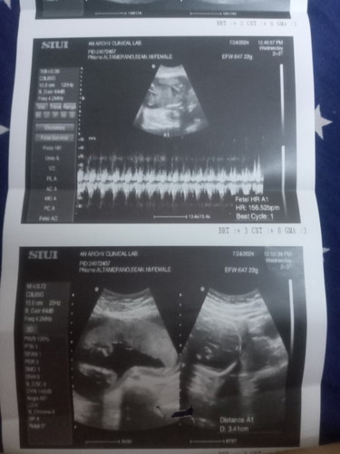 Paexplain naman po nung nasa ultrasound ko