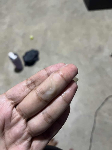 ใช้มูกไหมค่ะแบบนี้แต่ไม่มีเลือด