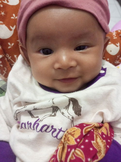 mata sebelah kiri lebih kecil