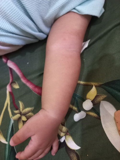 Warna Kulit Tidak Merata