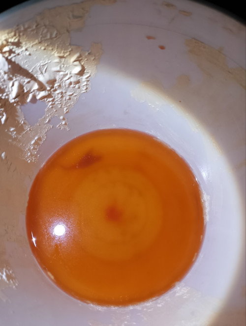 hiñdí pà po kasi àkp nakakapag patingin dahil saradó pa po ang pàcheck up ngayon kàßo may dugo padin