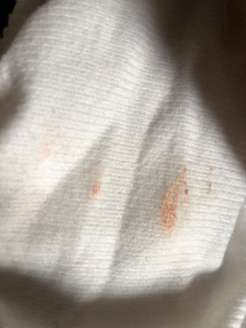 Bercak jingga pada pipis bayi 5 bulan 16 hari