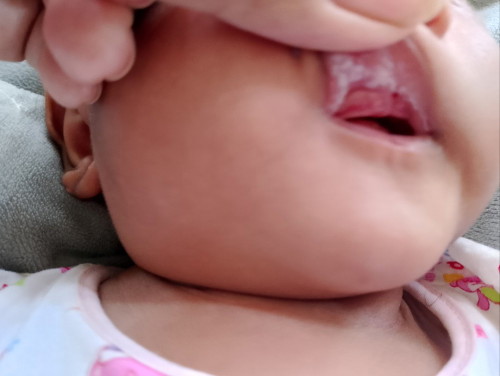 แม่ๆบ้านไหนมีลูกเป็นแบบนี้บ้างไหมค่ะ