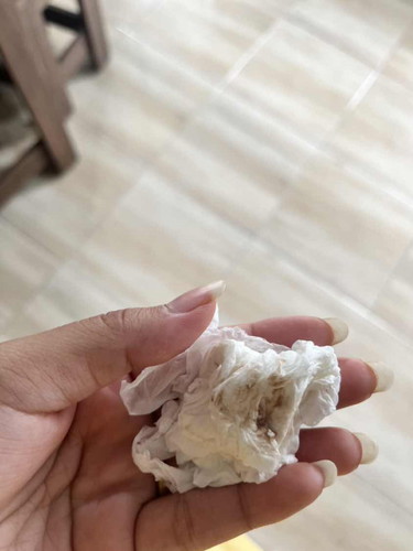 แบบนี้คืออะไร อันตรายมั้ยคะ