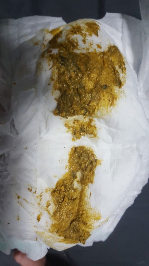 ลูกกินนมตัวนี้แล้วถ่ายแบบนี้เป้นอะไรไหมค่ะรึว่าแพ้