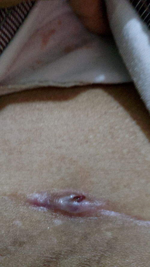 13 Juni saya lahiran secar