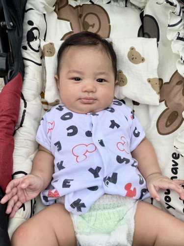 ไม่โกนผมไฟลูกจะเป็นไรไหม