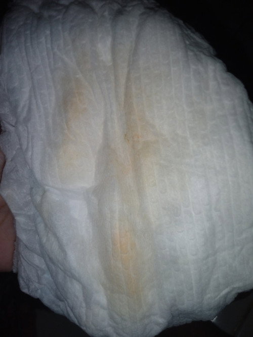 Air kencing bayi berwarna orange