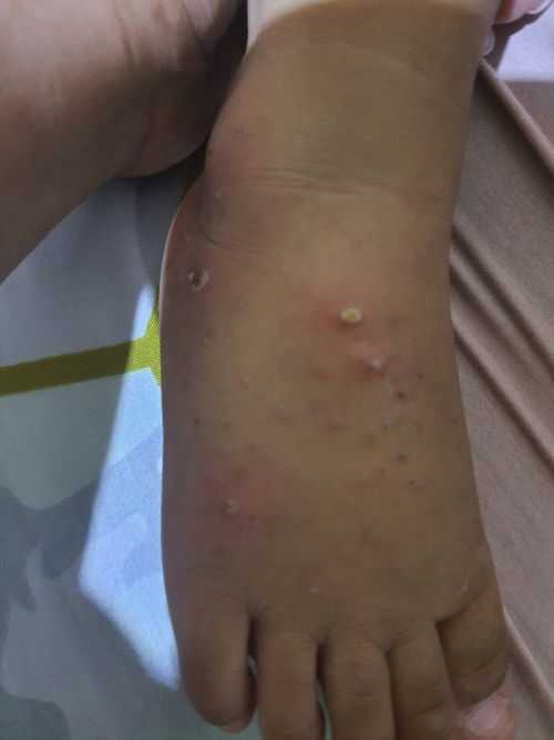 Bayi 11 bulan muncul melenting