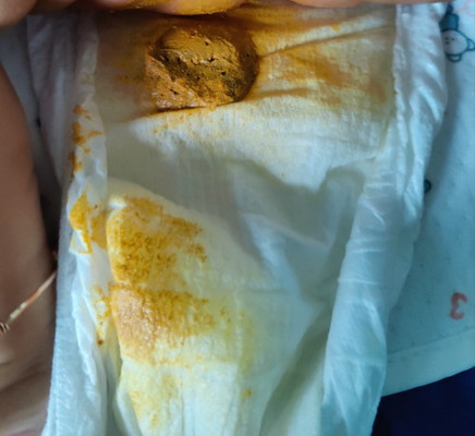 สอบถามเรื่องอึอึ๊น้องค่ะ