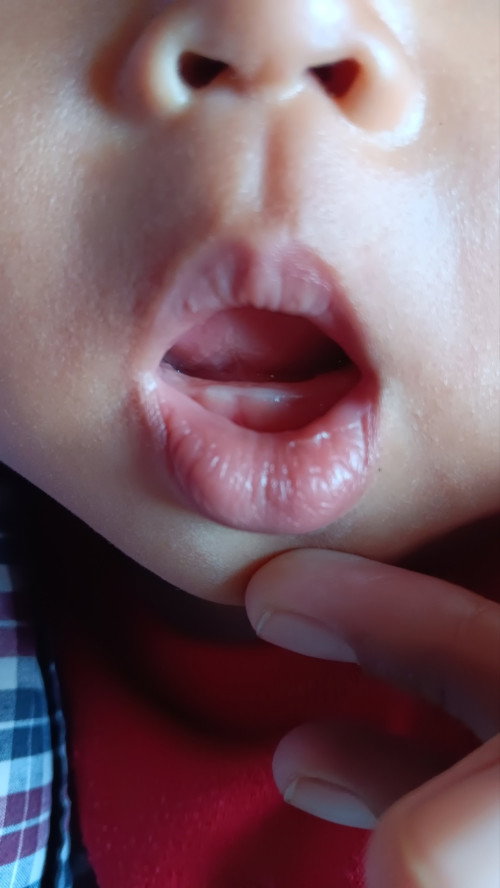 Tumbuh gigi