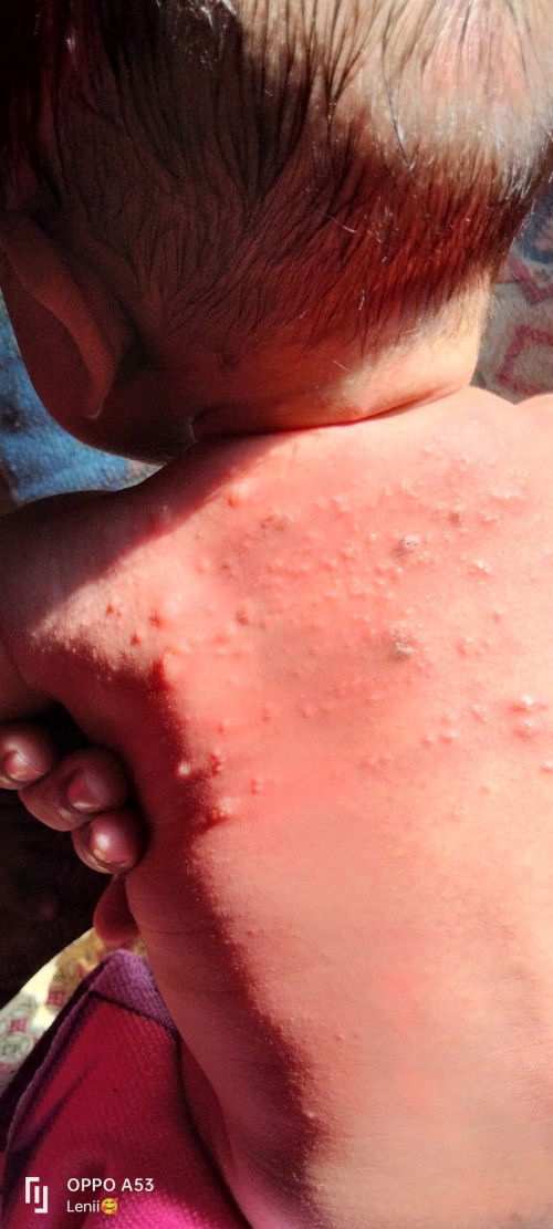 Maaf mau tanya ini begini penyakit apa ya , dan tolong yang tau obat nya apa ya  😭