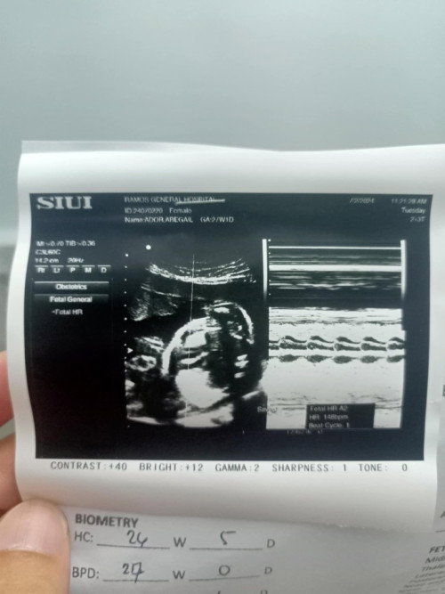 Hi momshies, sure na po bang baby girl po eto. Hehe