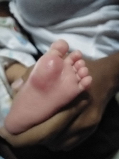 เท้าน้องเป็นอะไรคะ😭😭😭