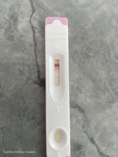 Tespek garis nya putih