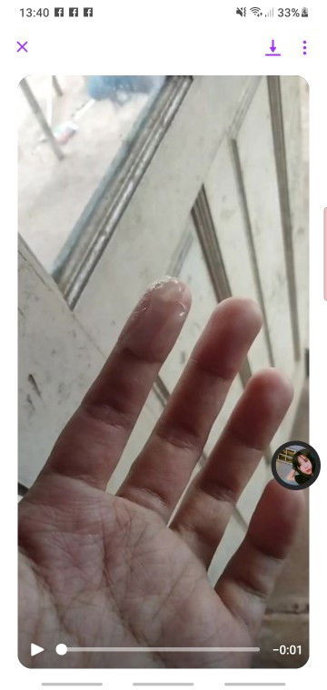 มูกหรือตกขาว