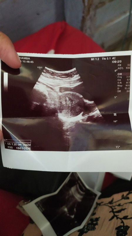 Mau curhat dong Bun..