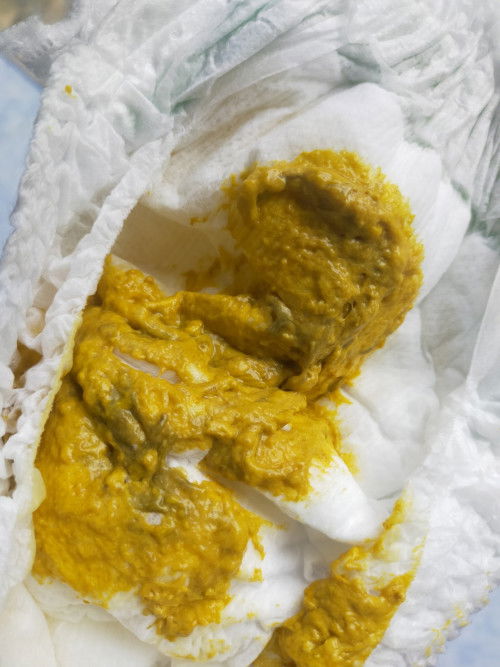 น้องอายุ2เดือน16วัน