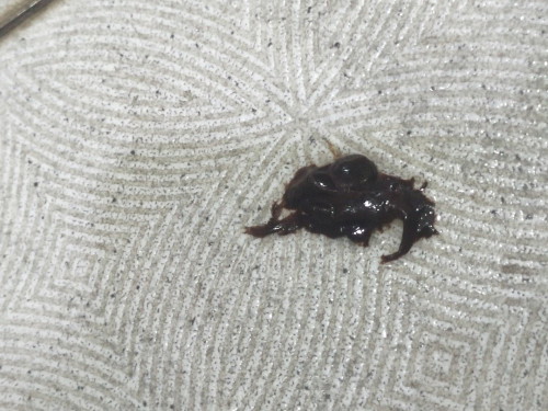 flek dan keluar gumpalan coklat