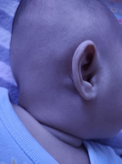 Biji belakang telinga