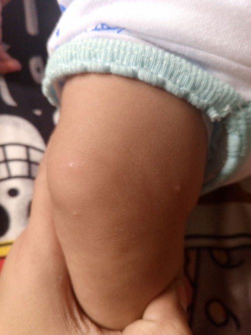 Nagkaganto po ba baby niyo ? Dumadami kasi mag 2 months pa lng