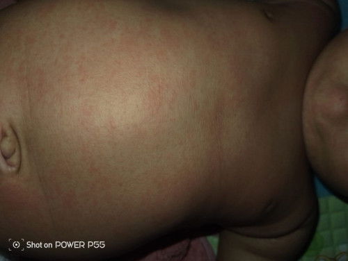 Saran dong bun yg baby nya pernah bgini