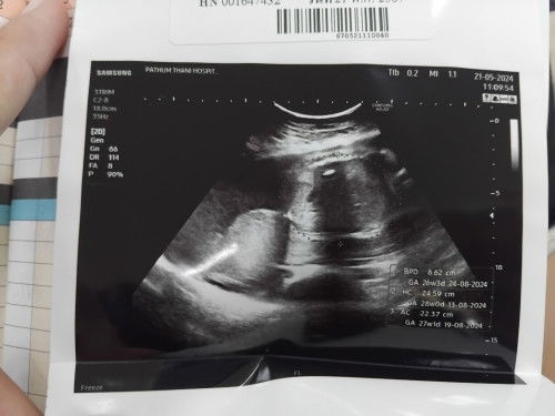 แบบนี้เพศอะไรคะพอดูออกมั้ย