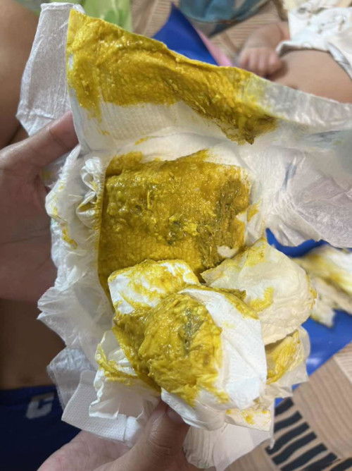 น้องกินนมแม่และนมผงอุจจาระสีแบบนี้ผิดปกติมั้ยครับ น้องพึ่ง2เดือน