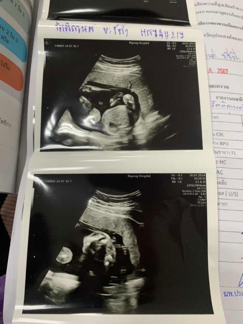 แม่ๆช่วยดูหน่อยน้องเพศอะไร