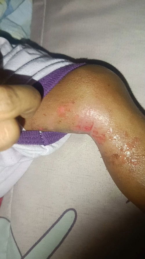 Assalamualaikum Nak tanye.cream ap yang Bagus untuk kulit baby ..baby Sy Baru 8bulan