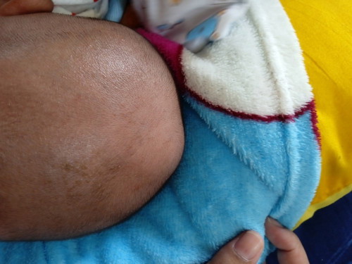 หัวน้องเป็นบูดๆนิ่มๆเหมือนมีน้ำข้างใน